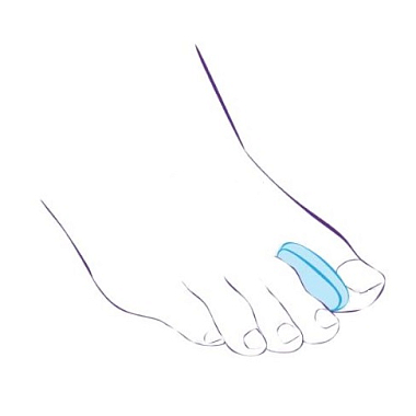 Купить Тривес приспособление ортопедическое силиконовое межпальцевые перегородки размер S Артикул СТ-32