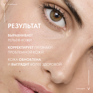 Купить Vichy Normaderm 30 мл сыворотка пробиотическая обновляющая против несовершенств кожи