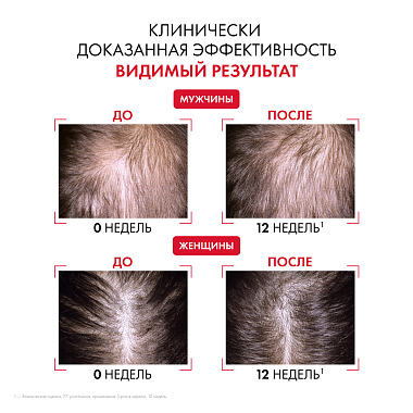 Купить Vichy Dercos Aminexil Clinical Regen Booster Hair Serum 90 мл сыворотка для волос